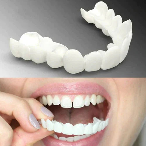Facetas Odontológicas Removíveis